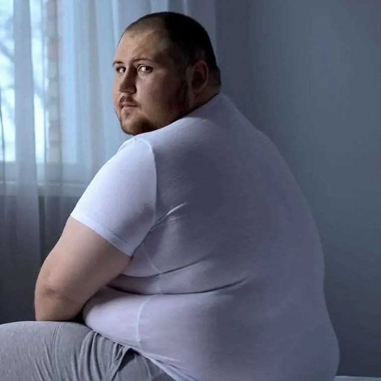 السمنة المفرطه